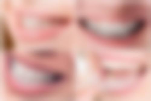 七、杭州国雅口腔毕文翔医生怎么预约？