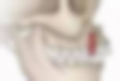 二、杭州国雅口腔毕文翔医生擅长项目