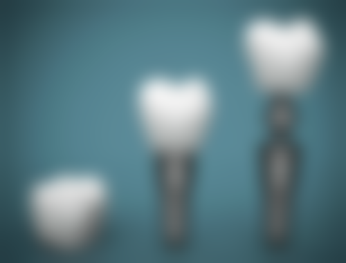 补牙时伤到牙神经多久可以好？一般需5 - 15天，恢复时间受恢复情况及有无肿痛等因素影响！ 