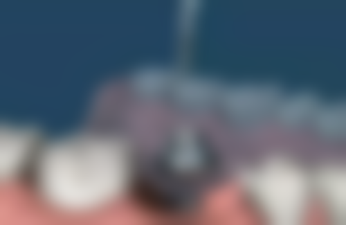 五、海南海口群上尔口腔收费价格表