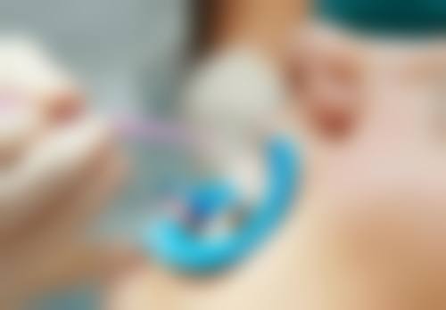 补牙可以直接填充吗？龋洞深浅是关键因素