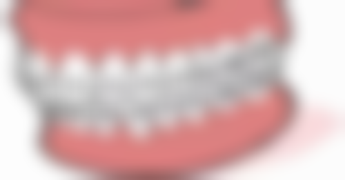 嘴突矫正必须拔牙吗？拔牙在矫正中的作用