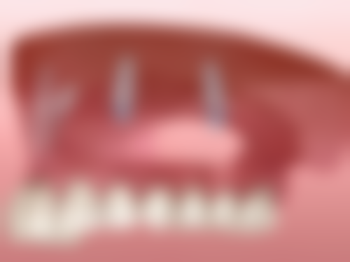 五、杭州国雅口腔于德珍医生技术怎么样？