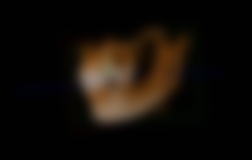 五、安徽巢湖铭德口腔收费价格表