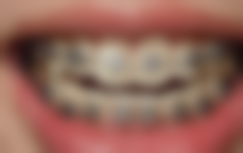 四、杭州国雅口腔林亨哲医生坐诊医院