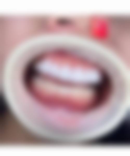 六、杭州牙典娜口腔门诊部口碑如何？