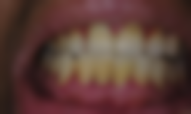 五、杭州国雅口腔林亨哲医生技术怎么样？