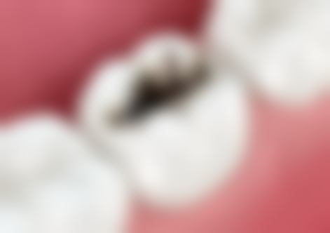 七、杭州国雅口腔张虹医生怎么预约？