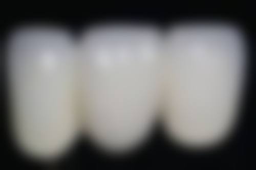 七、杭州国雅口腔于德珍医生怎么预约？