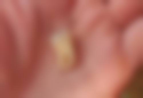 五、杭州国雅口腔于德珍医生技术怎么样？