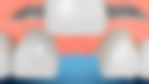 六、杭州国雅口腔万成锋医生口碑评价及真人实例反馈