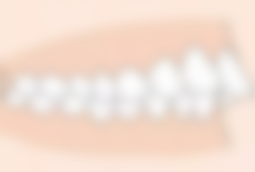 医生如何选择合适的方案