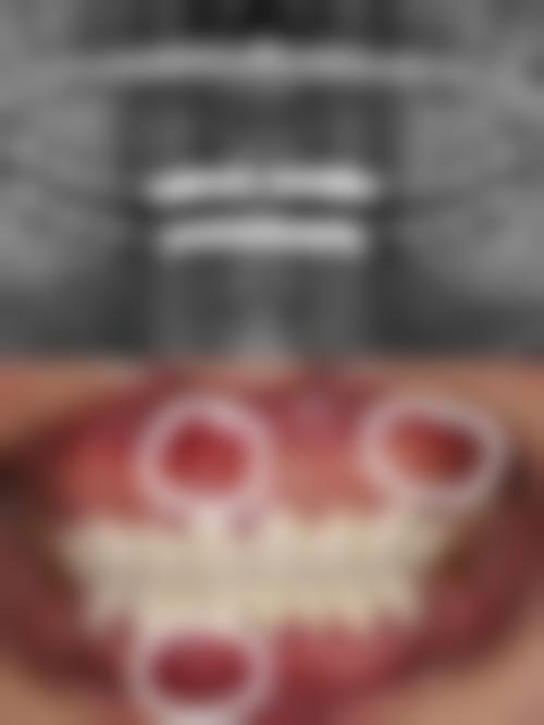 四、威海文登区唯美口腔特色项目