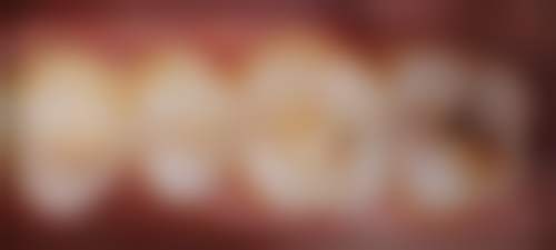 八、广东东莞厚街珊镁口腔怎么预约？