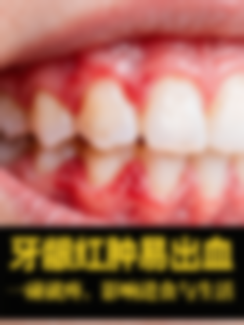 七、杭州国雅口腔张虹医生怎么预约？