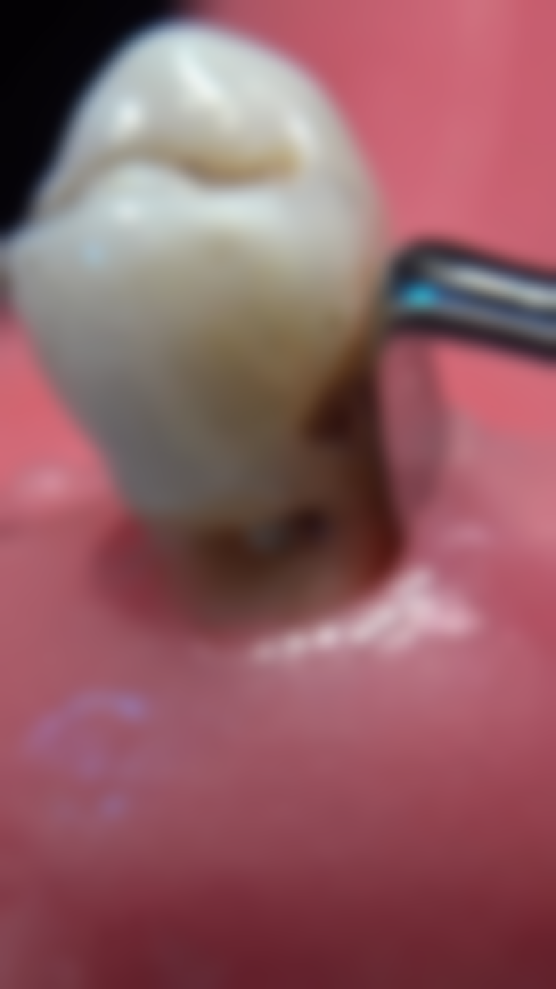 二、杭州国雅口腔于德珍医生擅长项目