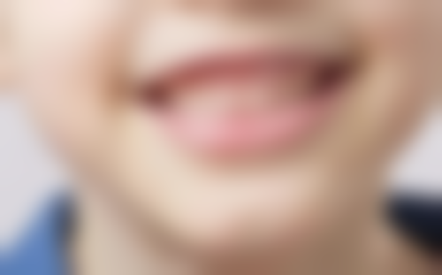 六、杭州国雅口腔毕文翔医生口碑评价及真人实例反馈