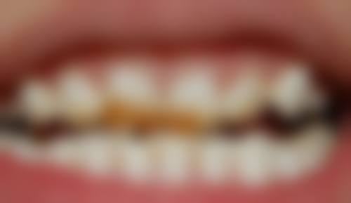 六、南通海虹口腔王海虹医生口碑评价及真人实例反馈