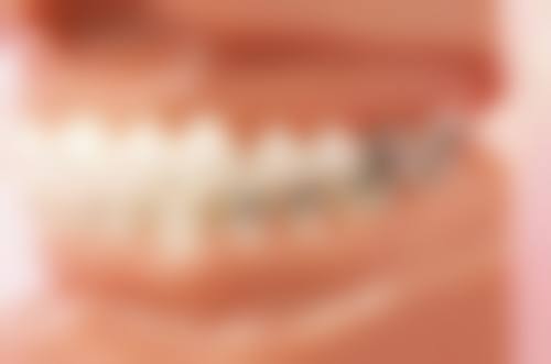 医疗保险卡拔牙报销的注意事项