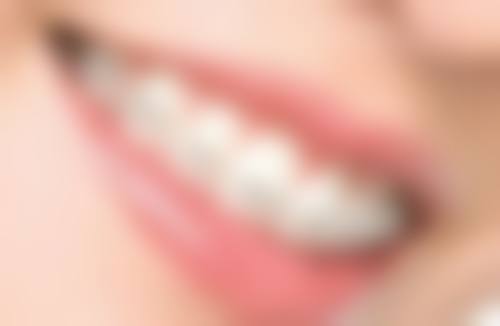 韩国植体的优势