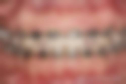 四、华容皇贝口腔门诊特色项目