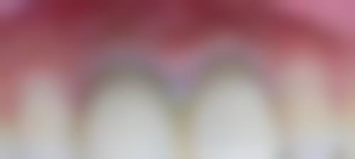 八、南通海虹口腔门诊部怎么预约？