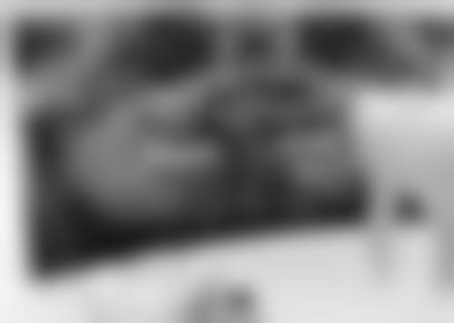 根管治疗怎么操作视频：根管清理与消毒