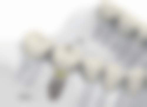 四、河北保定阳光口腔特色项目