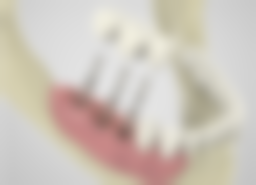 三、吉林四平伊通满族佳鑫口腔医生介绍