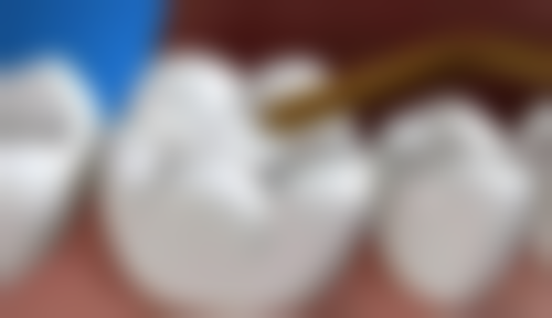 六、薄荷博士口腔门诊部口碑如何？