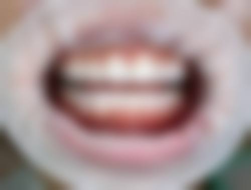 八、内蒙古呼和浩特刘文口腔诊所怎么预约？