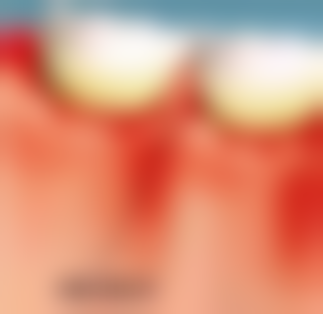 七、南通海虹口腔吴澄澄医生怎么预约？