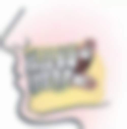 牙齿漏神经了必须做根管治疗吗？一般是，但年轻恒牙意外露髓可用保存活髓疗法！ 