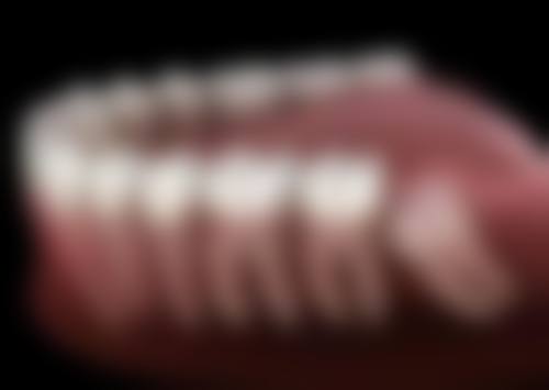 四、杭州国雅口腔万成锋医生坐诊医院