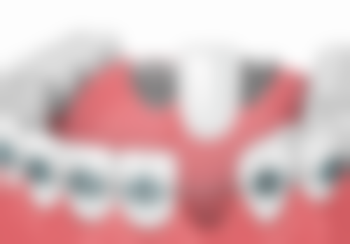 五、杭州国雅口腔林亨哲医生技术怎么样？