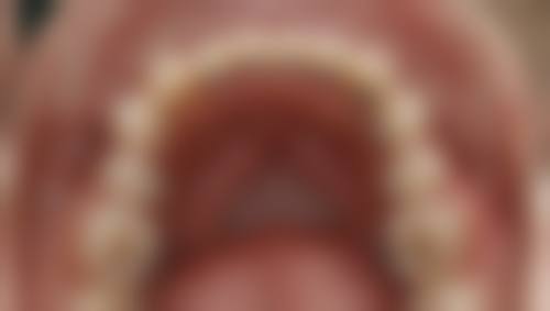 五、鹿泉佳伟口腔诊所收费价格表