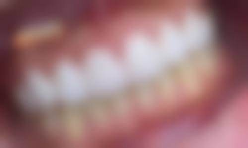 六、深圳鼎冠口腔门诊部(八卦岭分店)口碑如何？