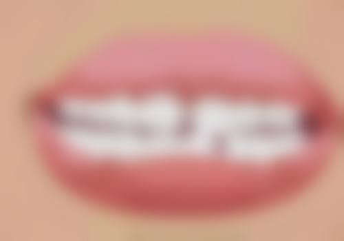 如何选择是否使用3m流动树脂补牙