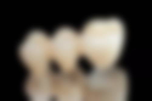 二、北京康贝佳口腔戎志诚医生医生擅长项目