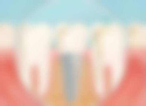 六、江苏无锡宜兴柳良胜口腔诊所口碑如何？