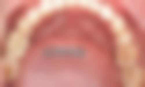 八、慈溪茂洁口腔怎么预约？