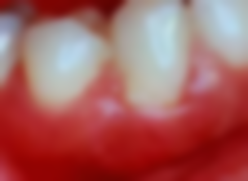 二、北京康贝佳科里斯托夫·艾斯纳医生擅长项目