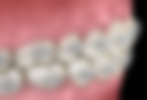 六、汕尾口腔薛瑶珑医生口碑评价及真人实例反馈