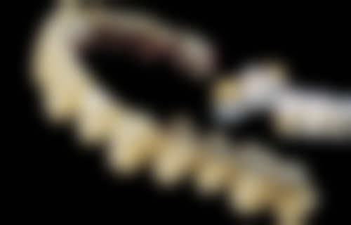 四、山东泰安陈晓口腔特色项目