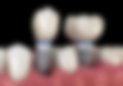 五、山东济南永鑫口腔收费价格表