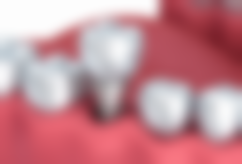 五、湖北武汉鑫齿口腔收费价格表