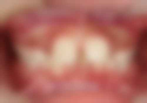 不当操作或护理可能引发多种问题