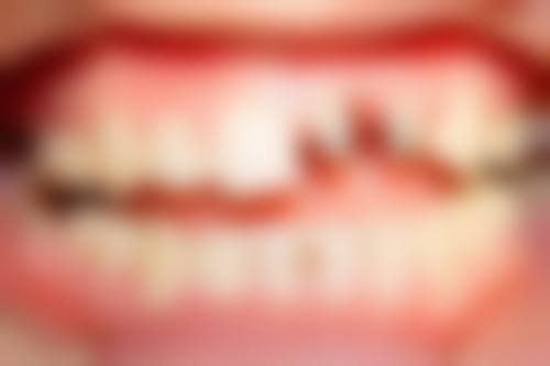 三、惠州安雅口腔医生介绍