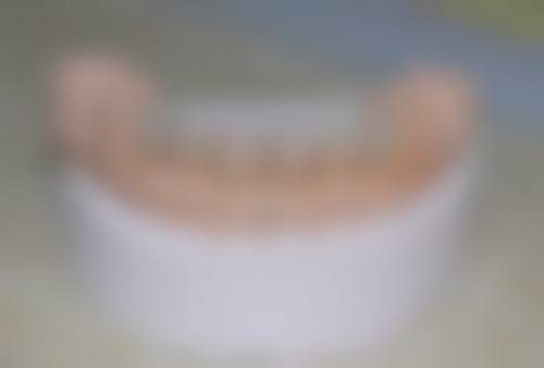 八、惠州安雅口腔怎么预约？