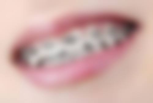 六、平城区楚璇口腔王昱医生口碑评价及真人实例反馈